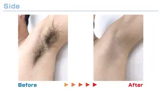 脱毛サロン moco selfのエステ・リラクイメージ