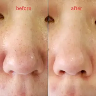 Noguchi staffのエステ・リラクイメージ