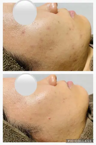 朝重い人専用 肩甲骨調整のエステ・リラクイメージ