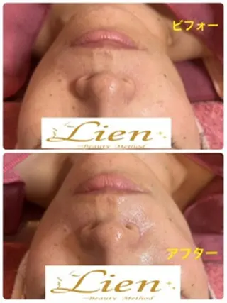 Lien オーナー　山口智嘉のエステ・リラクイメージ