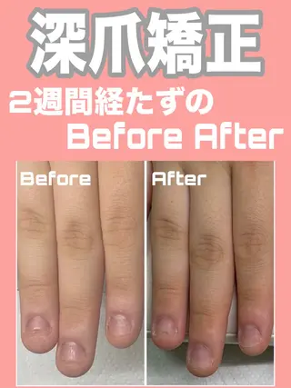 ネイル nail salon petillantのネイルデザイン