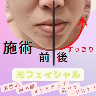 LUMINAルミナ 【肌管理サロン】のその他イメージ