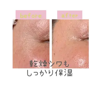 癒し腸もみサロン シャユーム　ゆきなのその他イメージ