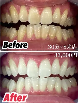 【歯科提携】柏ホワイ トニングスタイルのその他イメージ