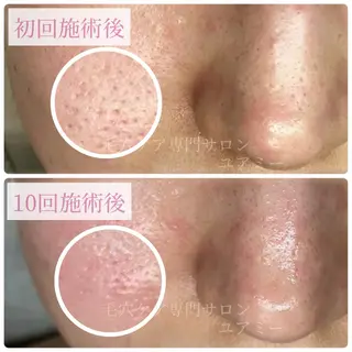 毛穴肌質ケアサロン Yourmeユアミーのエステ・リラクイメージ