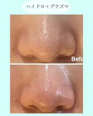 小顔＆肌質改善 NICORIのエステ・リラクイメージ