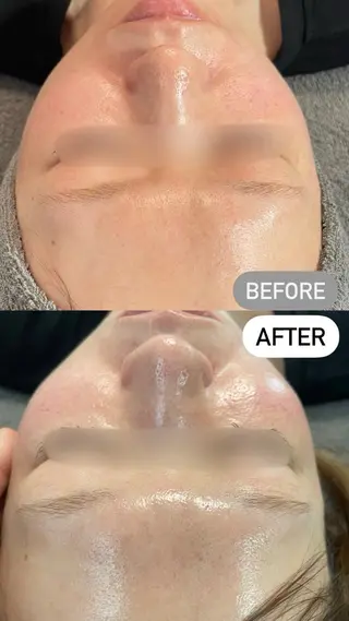 ele"ハーブ ピーリング 専門店のエステ・リラクイメージ