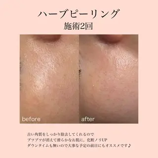 肌質改善×癒しサロン Bell skinのエステ・リラクイメージ