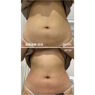 毛穴洗浄・痩身・脱毛 /アルカンジュのエステ・リラクイメージ