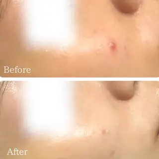 毛穴ニキビ専門 ビューティーグランツのエステ・リラクイメージ