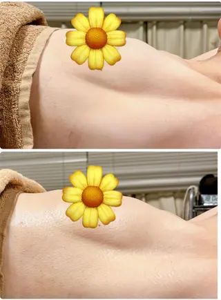 脱毛/BBL/SHR PBSサロンAirのエステ・リラクイメージ