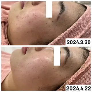 【現役看護師】高来 笑子のエステ・リラクイメージ