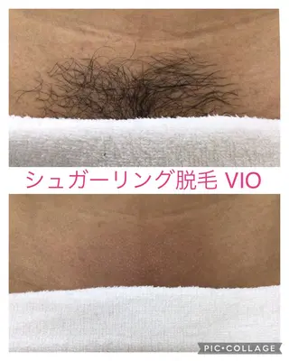子宮矯正/腸揉み/ シュガーリング脱毛のエステ・リラクイメージ