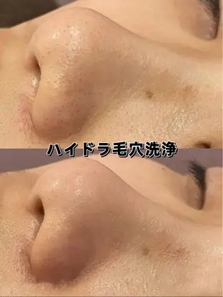 美BELLO 池袋のエステ・リラクイメージ