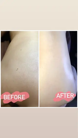 脱毛＆エステサロン JIGGLY☆松田のエステ・リラクイメージ