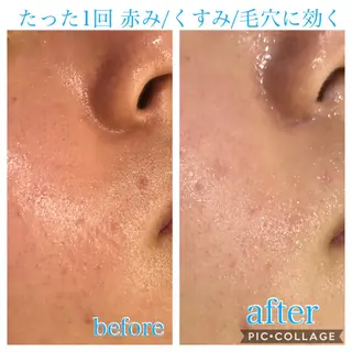 ショート カラー パーマ ヘアアレンジ メンズ キッズ ネイル マツエク・マツパ EnsorClair 代表　野口真央のエステ・リラクイメージ