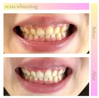 セルフホワイトニング エクシア武蔵小杉店のその他イメージ