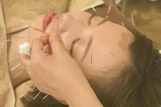 💙美容鍼💙美顔矯 正🧡Brilo🧡のエステ・リラクイメージ