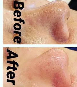 o3remedy所属・宇野澤 彩加のエステ・リラクイメージ