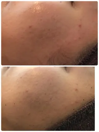 LILIANA ☆YURIのエステ・リラクイメージ