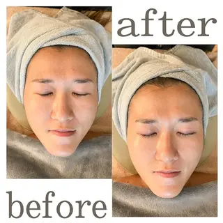 うなじ脱毛/美肌脱毛 LABELのエステ・リラクイメージ