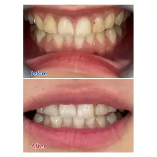 M渋谷 ホワイトニングのエステ・リラクイメージ