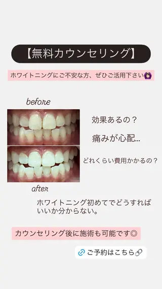 ホワイトニングサロン yatto.のその他イメージ