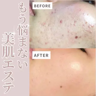 肌質改善専門サロン Bellmi/心斎橋のエステ・リラクイメージ