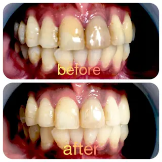 ネイル two nailのネイルデザイン