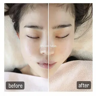 石川 真梨奈  美容鍼灸/アロマのエステ・リラクイメージ