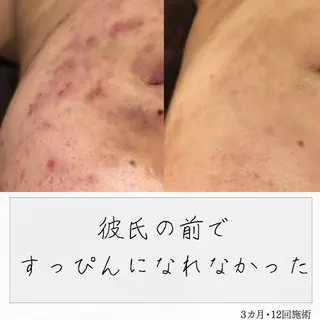 ニキビ経験者が施術 する専門サロン🌻のエステ・リラクイメージ