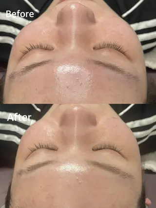 小顔専門看護師クリニカルサロンCOCO所属・小顔と美肌サロン クリニカルサロンココのエステ・リラクイメージ