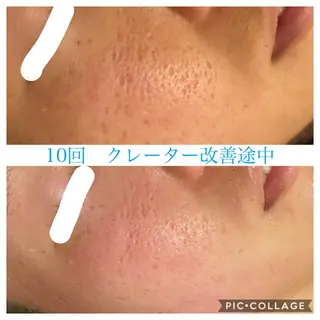 ロング カラー パーマ ヘアアレンジ メンズ キッズ ネイル マツエク・マツパ EnsorClair 代表 野口真央のエステ・リラクイメージ