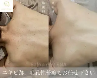 ハーブピーリング専門 サロンドレナ平岡のエステ・リラクイメージ