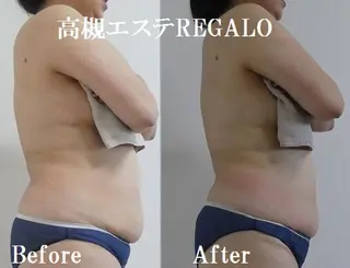 REGALO所属・矢野 さやかのエステ・リラクイメージ