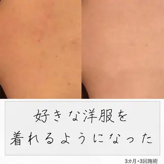 ニキビ経験者が施術 する専門サロン🌻のエステ・リラクイメージ