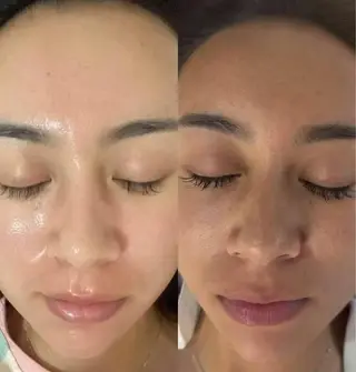 マツエク・マツパ aliaハーブ水光店 エステティシャン募集のエステ・リラクイメージ