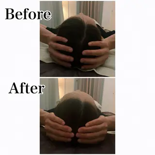 ielu〜毛穴ケア ハーブピーリングのエステ・リラクイメージ