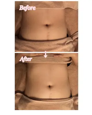 横浜石川町 こりケア 専門lala mouのエステ・リラクイメージ