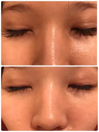 y.laBelle 艶肌・小顔・肌質改善のエステ・リラクイメージ