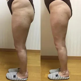 プライベートサロン soleilのエステ・リラクイメージ