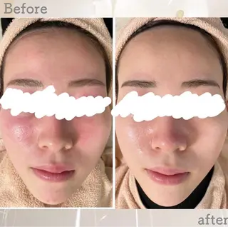 都度払い肌改善専門店 店長二上文香のエステ・リラクイメージ