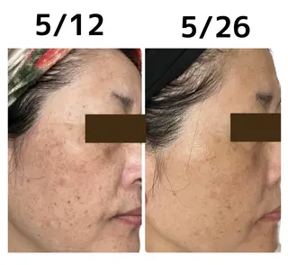 stella所属・stella都度払い 痩身小顔まつげパーマのマツエク・マツパデザイン