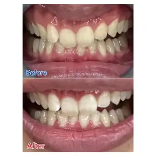 Ｍ渋谷 ホワイトニングのエステ・リラクイメージ