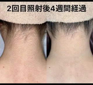 LOUISE.／脱毛所属・LOUISE. ／脱毛のエステ・リラクイメージ