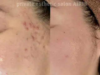 AIRIS 船橋店のエステ・リラクイメージ