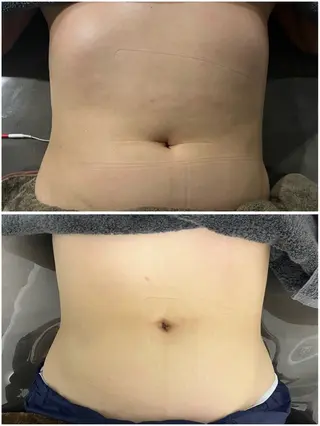 湘南エステサロン moaのエステ・リラクイメージ