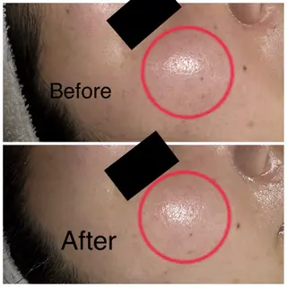 ROR所属・ROR Nanaのネイルデザイン