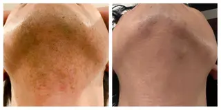 アイブロウ メンズ Renatus 脱毛/美肌/眉/痩身のエステ・リラクイメージ