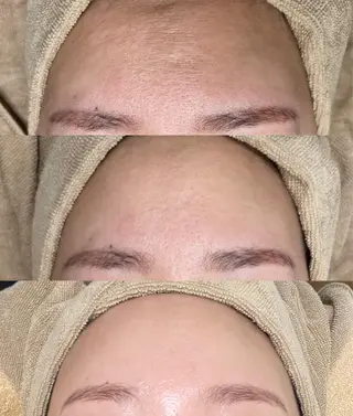 エステサロン Mi-mi.iのエステ・リラクイメージ